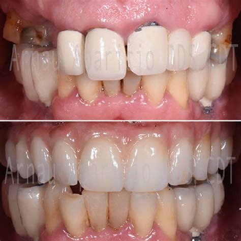 Before & After Images | QDT Dental