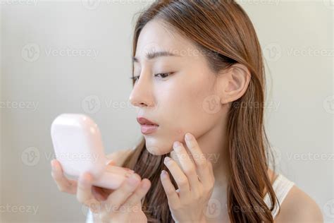 Woman worried about face Dermatology, rosacea dermatitis, allergic