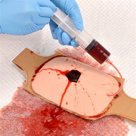 What is a Puncture Wound? Causes, Risks, and Examples – MedEduQuest