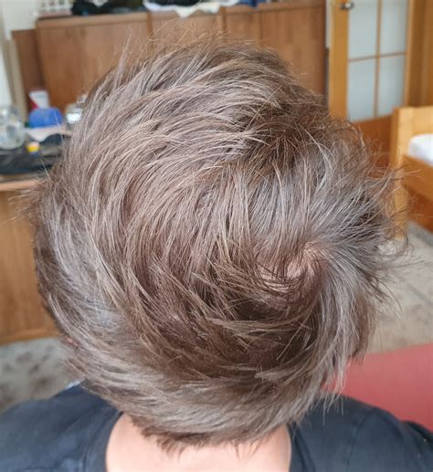 Minoxidil with Finasteride Topical Solution | Dualgen-15 With PG Plus