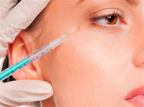 Биоматрикс (biomatrix) мезотерапия: отзывы косметологов и клиентов ...