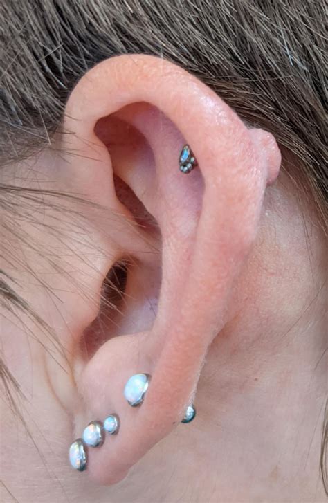 Kevin Update: 24hr post steroid injection and it looks like he's