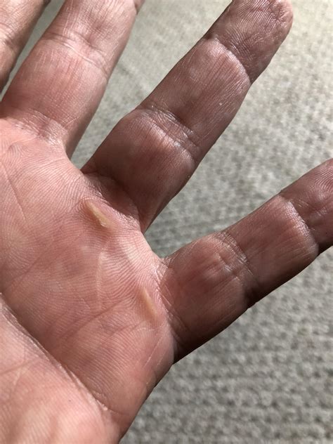 Battle scars? Maybe it’s time for driving gloves. : r/granturismo