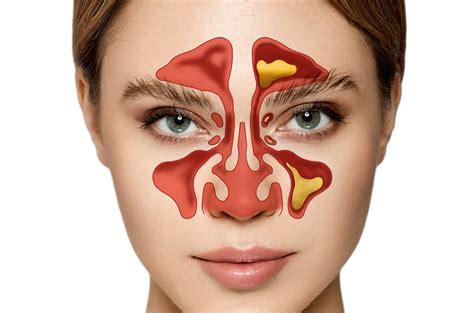 Nose Shapes in different Races : 네이버 블로그