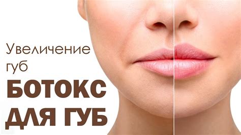 Увеличение губ. Ботокс для губ. - YouTube