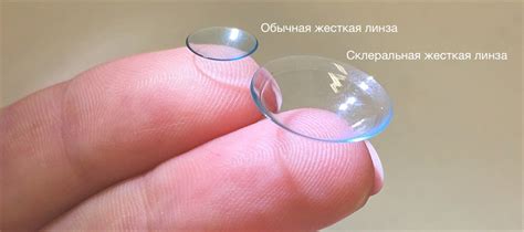 Склеральные Линзы — Окулист