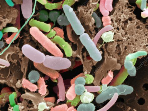 SEM of Smegma - Stock Image - P710/0504 - Science Photo Library