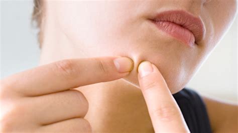 Best 12 This Super-Gross Blackhead Removal Video Has Been Watched More