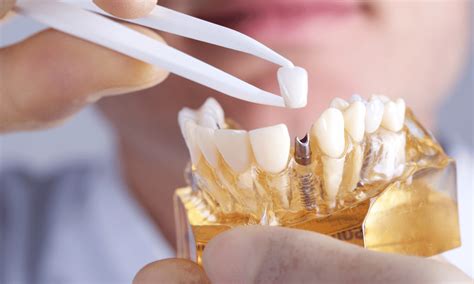 pfm  zirconia  material     patient