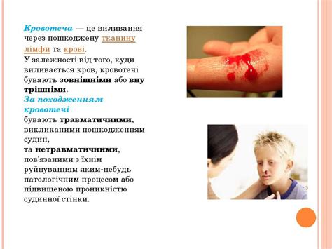кровотеча - презентація з медицини