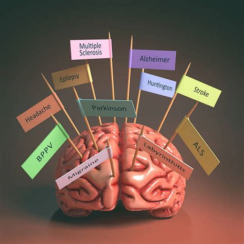 What is huntington's disease - Newstrendline.Com