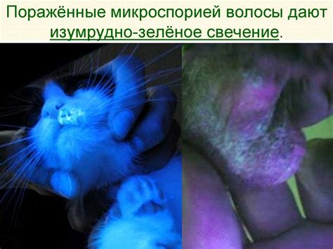 Микроспория - презентация онлайн