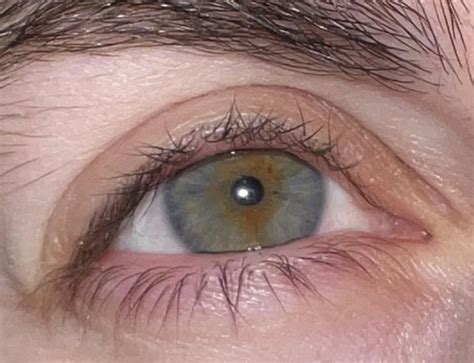 Hazel or Central Heterochromia : r/eyes