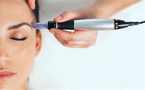 Microneedling: What is it and how to do it at home