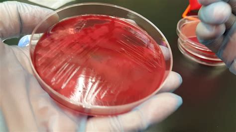 Clostridium Perfringens Colony