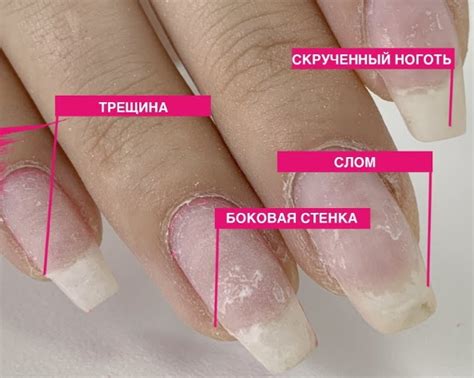 Сломался ноготь. Что делать, как починить под гель-лаком, шеллаком ...