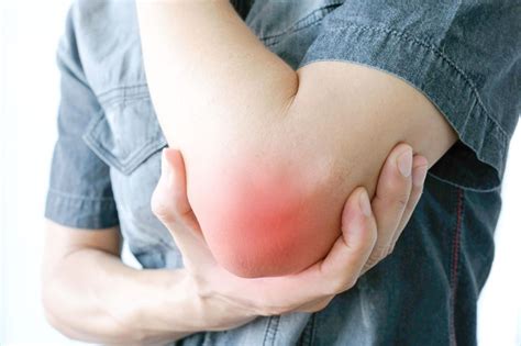 Бурсит: симптомы, причины, методы лечения