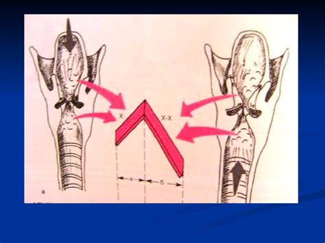 Аускультация легких. Метод аускультации - презентация онлайн