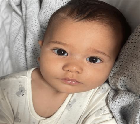 Managing your baby's head shape | Ocean Kids Health