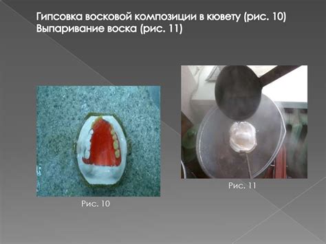 Съемное протезирование зубов - online presentation