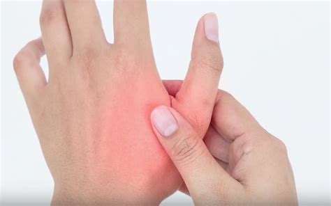 Thumb osteoarthritis, thumb arthritis, thumb pain, arthritis in hand ...