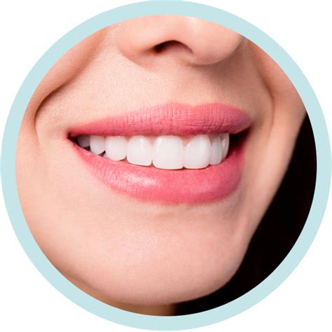 veneers cavendish house dental practice