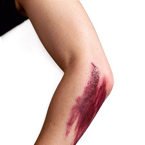 [100+] Bruise Png Images | Wallpapers.com