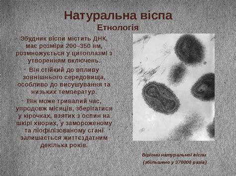 "Вірус віспи" - презентація з медицини