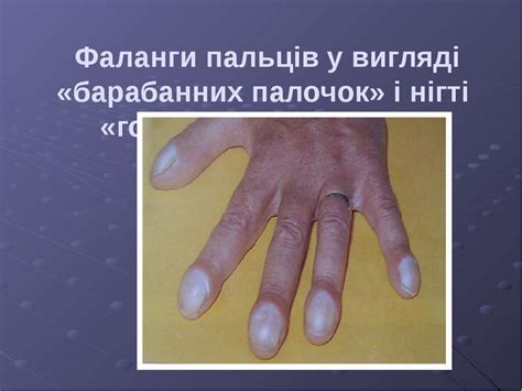 Презентація лекції для студентів медичного коледжу "Патоморфологія ...