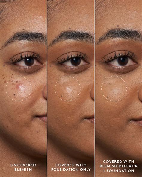 Blemish Defeat'r - Salicylic Acid Spot Treatment | Fenty Skin