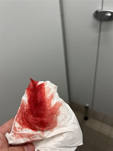 Is this a normal period blood clot? : r/Periods