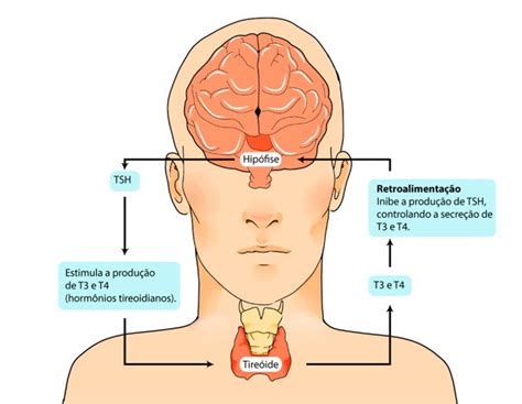 Hipotireoidismo O Que Causa - Hipotireoidismo: o que é, causas e tratamento - Toda Matéria