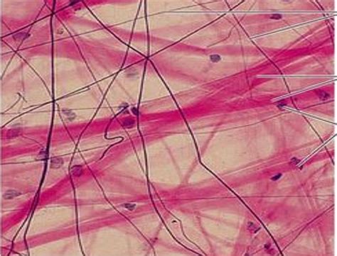 loose fibrous diagram quizlet