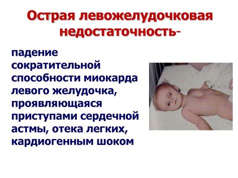 Врожденные пороки сердца. Недостаточность кровообращения - презентация ...