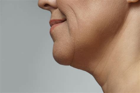 Receding Chin - Freyja Medical