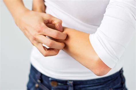 Two brain pathways identified that govern the urge to itch | New Scientist