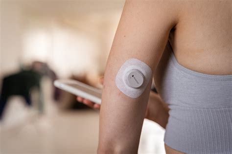 dexcom  appears  health canadas list  approved devices