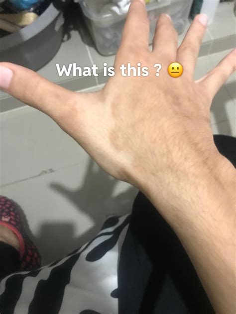 What is this? 😐 : r/medical_advice