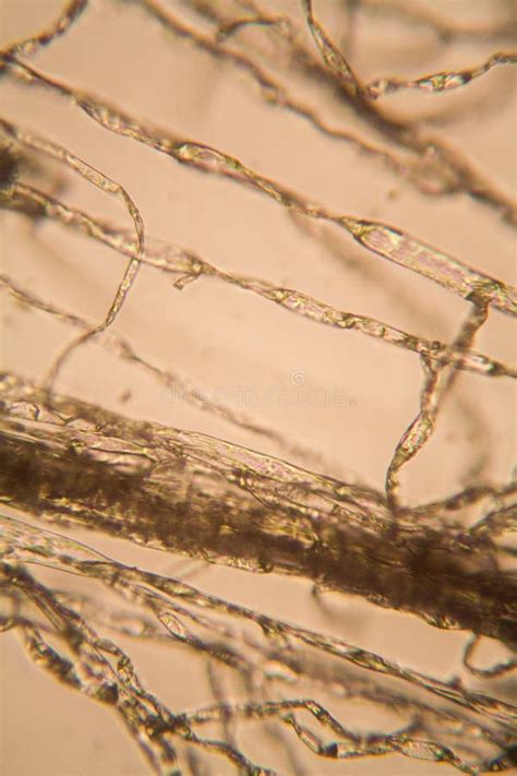Mold at the microscope stock image. Image of microorganisms - 111147769