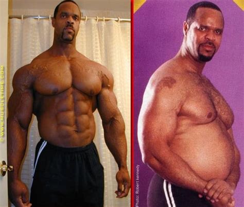 Before and After Steroids DeTransformations, Bodybuilders That Lost It All