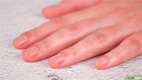 Effective Ways to Treat and Prevent Dry or Peeling Fingertips