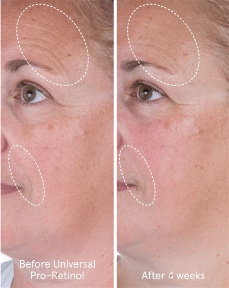 universal pro retinol glossier