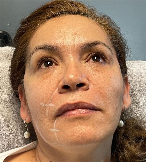 Nuderma Health & Med Spa | Raleigh NC