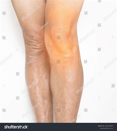 Leg Knee Joints Elderly Muscle Bone Stock Photo 2202249945 | Shutterstock
