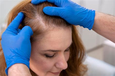 how to stop hair thinning on crown