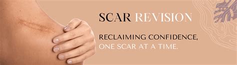 scar revision treatment uksderma