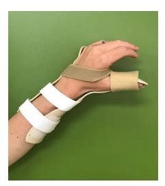 Extensor Pollicis Longus Injury Treatment