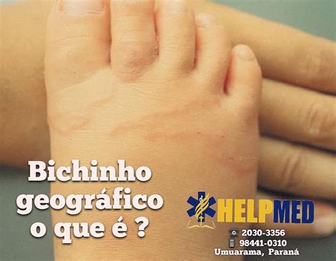 Bicho Geográfico Como Pega - 6
