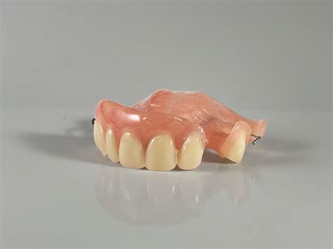 Types of Partial Dentures