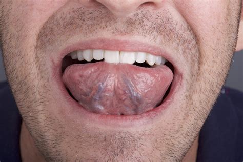 What Is Skin Called Under Tongue at JENENGE blog